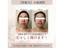 レアン(Lea.n)の雰囲気（美容整形は怖いけど、若々しく在りたい女性へ）