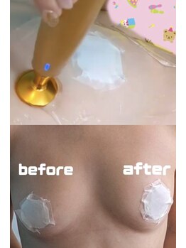 エレガンテ(ELEGANTE)/バストケア&バストアップ