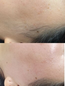 アイコトバ バイ ジュモク(アイコトバ by Jumoku)/フェイスワックスもみあげ+頬