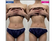 コリオ(KoRiO)/痩身1回目のお客様［狭山ヶ丘］