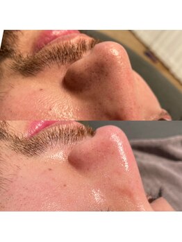 ひっそり美肌構築/ハーブの効果！