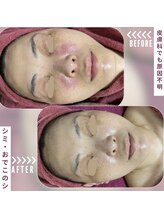 リベル(ReBelle.)/