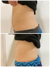 ルナート(Lunart)/美腸くびれモニター