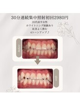 プラスビーセルフ(+b self)/ホワイトニングビフォーアフター