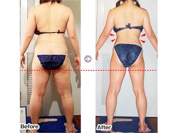 痩身 セル脂肪専門 スタイルデザイン/冬でも魅せるボディライン★