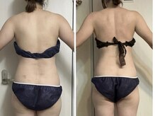 ヨサパーク ルポ(YOSA PARK ropos)/天使の羽♪