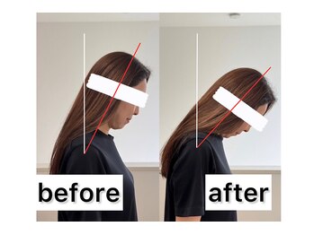 ヘルシールーム 六本木7丁目店(Healthy room)/before/after【スマホ首改善】