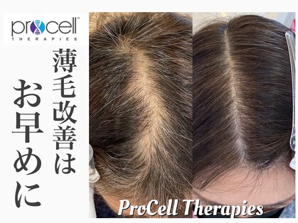 レイ(Rey)の写真