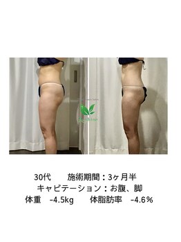 リシャイン(Reshine)/ビフォーアフター