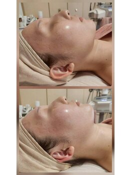 ロータスマップ(LOTUS MAP)/