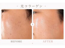 パールプラス 伊勢店(Pearl plus)/肌荒れ/毛穴の引き締めにも◎