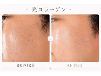 パールプラス 伊勢店(Pearl plus)/肌荒れ/毛穴の引き締めにも◎
