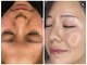 エンビ(enbi)の写真