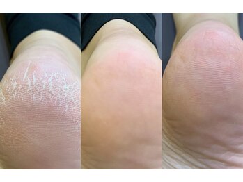 スピラーレ(SPIRALE)/メディケアクレンジングの凄さ！