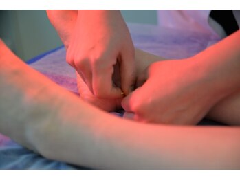 いろはり/施術風景1