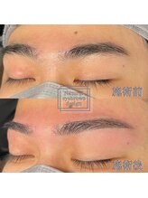 アイブロウマン(i Browman)/眉毛で大人の男に大変身
