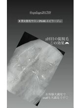 美容脱毛専門サロン エピラージュ 新宿店(Epilage)/ヒゲも全身脱毛も爆抜け！