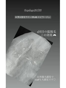 美容脱毛専門サロン エピラージュ 新宿店(Epilage)/ヒゲも全身脱毛も爆抜け!