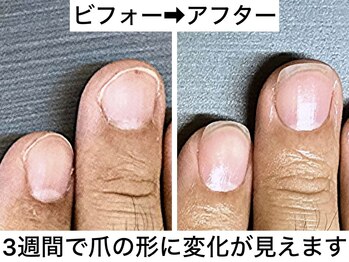 桃の木 吉祥寺店/爪の形は変わります