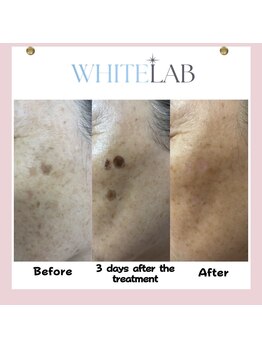 ヴィーナス 浦安店(VENUS)/ホワイトラボ