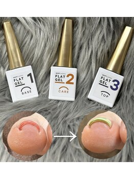 ビューティーサロンフルール(fleur)の写真/【巻き爪ケアもオシャレもどちらも叶える!】フラットケアジェル入荷しました♪
ワンカラー込み10450円