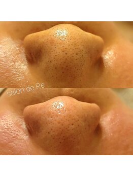 サロンドリー(salon de Re)/超音波エクストラクション