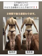 アローナ(ARONA)/ARONAの本気の痩身