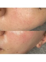 ルーム(room)/フェイスワックス