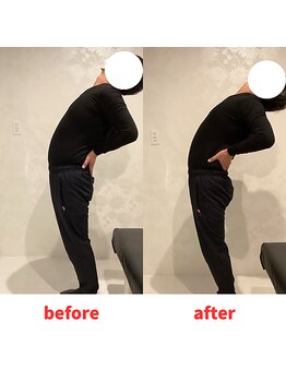 ナオル整体 福岡香椎院(NAORU整体)/50代男性施術事例【腰の痛み】