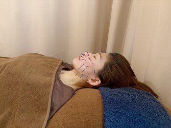 こじま 富雄団地接骨院/ヒト幹細胞美容鍼