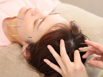 ときのはり鍼灸院(TOKINOHARI)/美容鍼