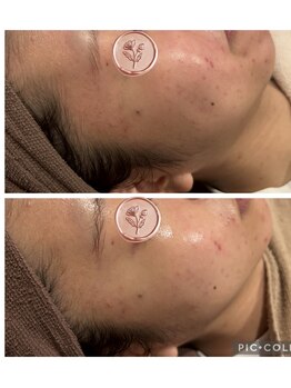 お肌をきれいにしたい