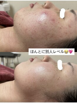 リベル(ReBelle.)/