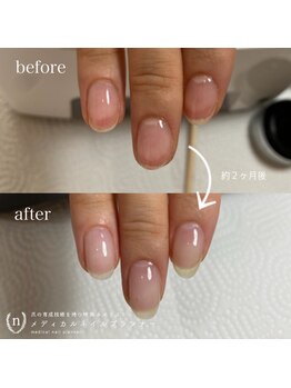 スイ(Sui)の写真/自爪育成ができる資格取得済み。