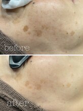 ドットエム(.m)/RF光フェイシャル