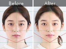 ハリラウンジ 恵比寿本店(Hari Lounge)/美容鍼専門サロン Hari Lounge