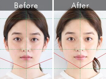 ハリラウンジ 恵比寿本店(Hari Lounge)/美容鍼専門サロン Hari Lounge