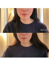 ロアー 赤坂店(RAWR)/むくみ改善！