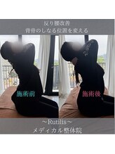 ルチルス(Rutilis)/姿勢改善整体