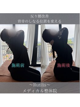 ルチルス(Rutilis)/姿勢改善整体