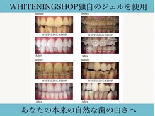 ホワイトニングショップ 刈谷店