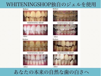ホワイトニングショップ 刈谷店の写真
