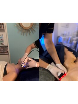 ブライダルメニューがあるサロン