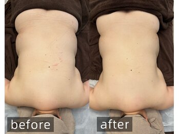 マハロ(mahalo)/ボディラインスッキリ