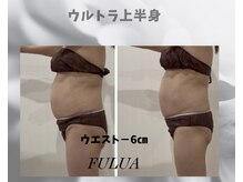 フルーア(FULUA)/ウルトランスフォーマー上半身