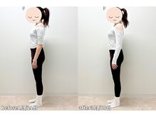 モア 札幌平岸店(MORE)/ヒップアップと横ももの張り取り