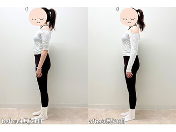 モア 札幌平岸店(MORE)/ヒップアップと横ももの張り取り