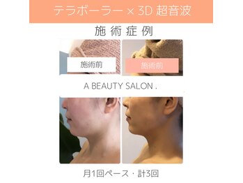エービューティーサロン 松山店(A BEAUTY SALON.)/40代女性　二重アゴ改善