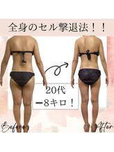 サロン ド ボーテ ラーンジュ 岐阜店(salon de beaut'e L'ange)/ハイパ-ナイフEX2ダイエット痩身