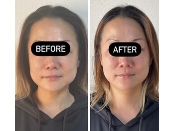 はんなり/テラボーラ